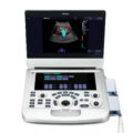 edan-acclarix-ax3