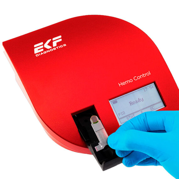 ekf-hemo-control-3